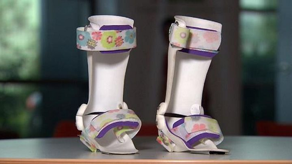 Компания AbilityMate изготовила 3D-печатные «сапоги-скороходы» для девочки с церебральным параличом