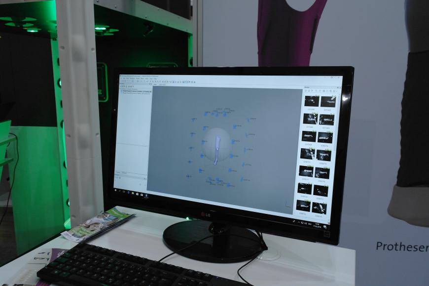 Аддитивные технологии в протезировании