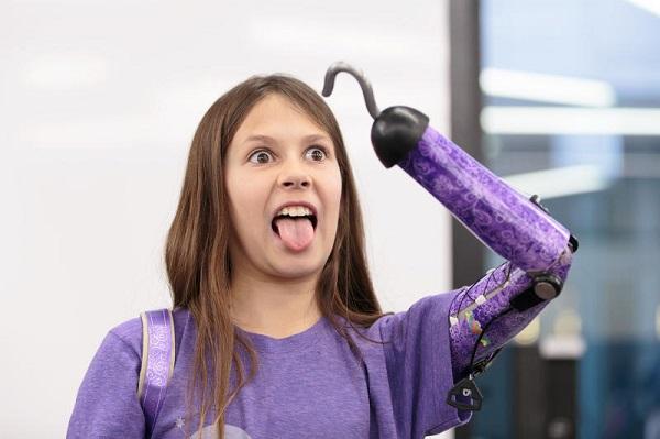 Блесткомет вместо руки, или Как одиннадцатилетняя девочка создает 3D-печатные протезы