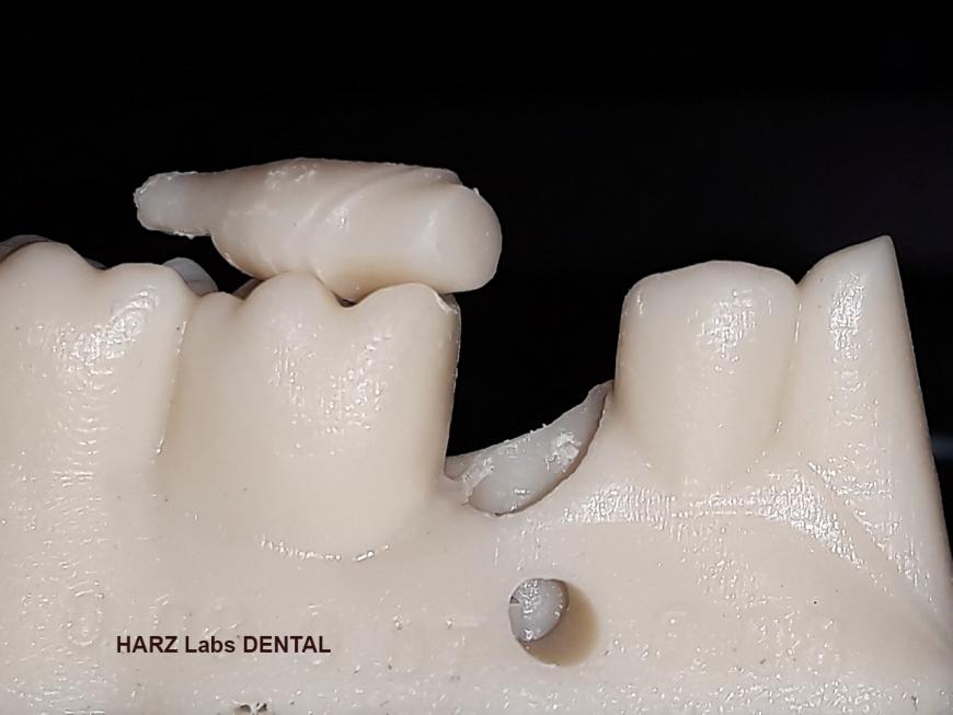 HARZ Labs DENTAL SAND A1-A2 Пробная печать кусалок и жевалок. UNIZ PLUS
