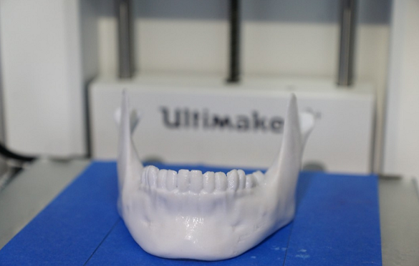 Нижегородские студенты-медики практикуются на 3D-печатных стоматологических макетах