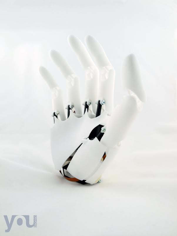 Норильский инженер создает бионический протез руки и хочет распространять его бесплатно