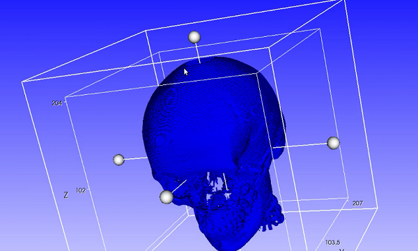 Российские ученые разрабатывают программный комплекс для 3D-моделирования и 3D-печати эндопротезов