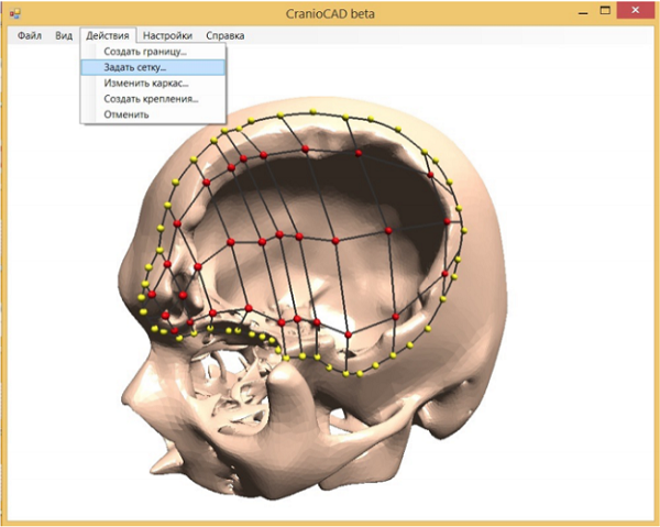 Магистрант НГТУ разработал специализированную программу для 3D-моделирования и 3D-печати имплантатов