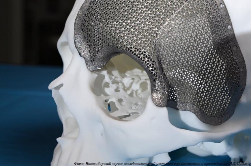 Российские врачи готовят рекомендации по использованию 3D-печатных медицинских изделий