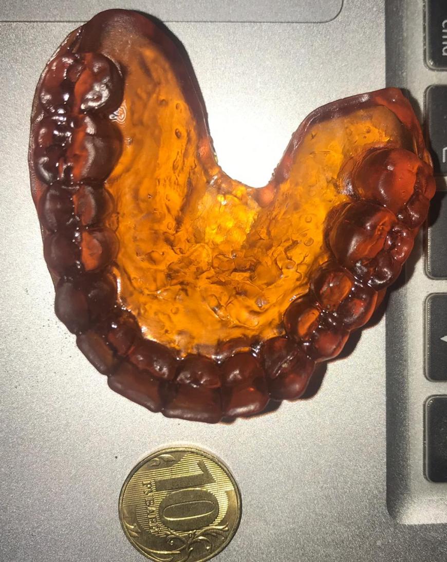 Зубы на стоматологическом принтере 3D Artel Zobu