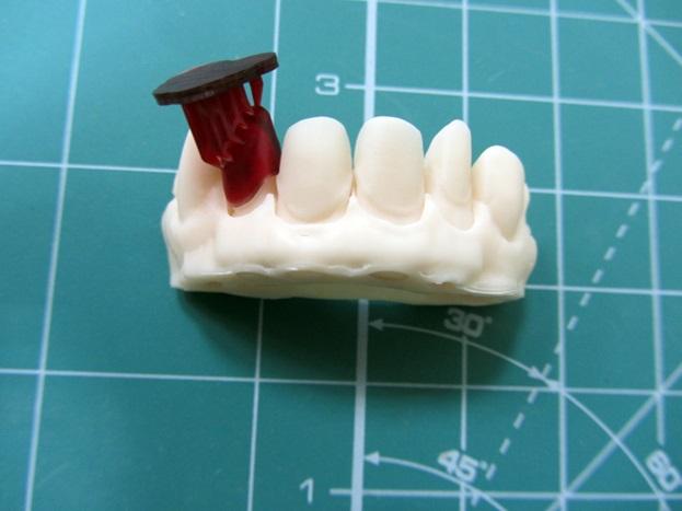 Nobel Superfine для использования в стоматологии