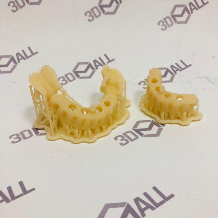 Временные коронки из фотополимера по технологии SLA
