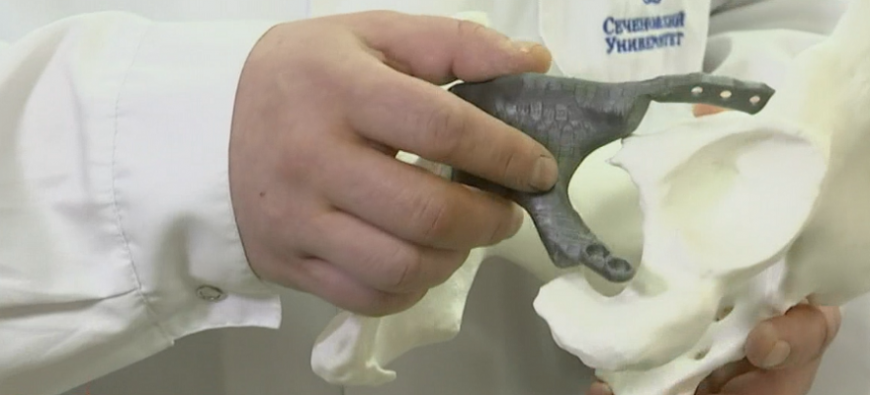 В Сеченовском университете провели сложную операцию с использованием 3D-печатного имплантата