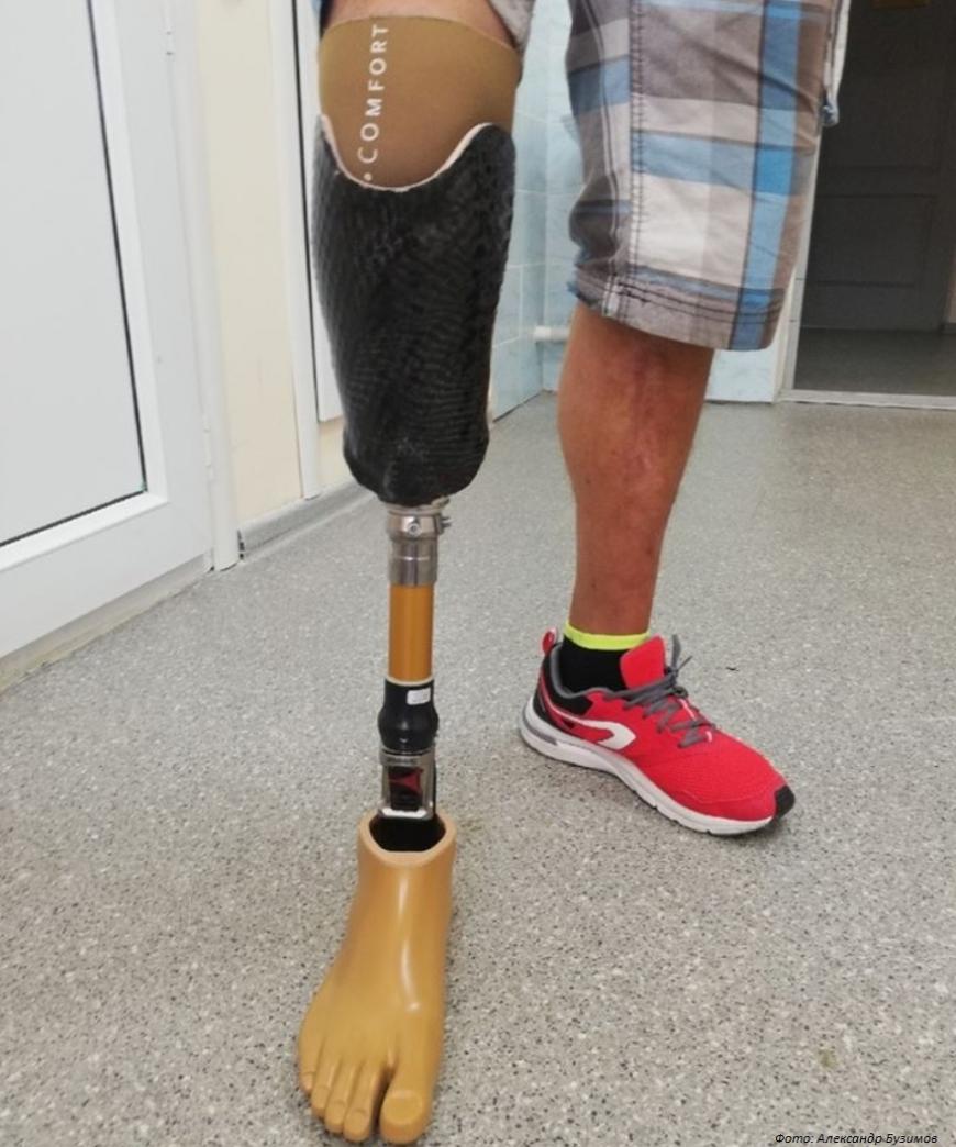 В Томске ведутся испытания протезов ног с 3D-печатными культеприемными гильзами