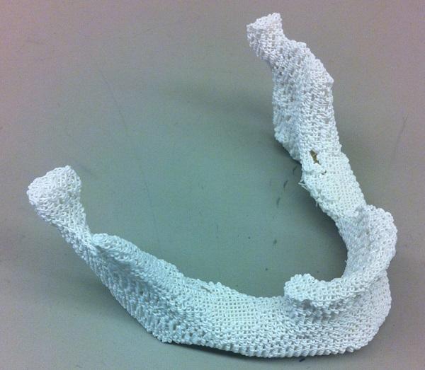 Эффективность 3D-печатных костно-полимерных имплантатов доказана опытным путем