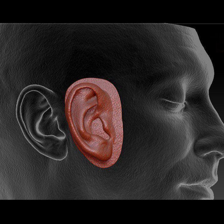 3d-модель имплантата ушной раковины
