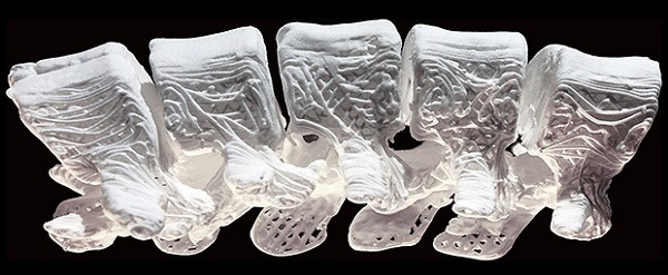 3D-печатные эластичные имплантаты повысят эффективность костной хирургии