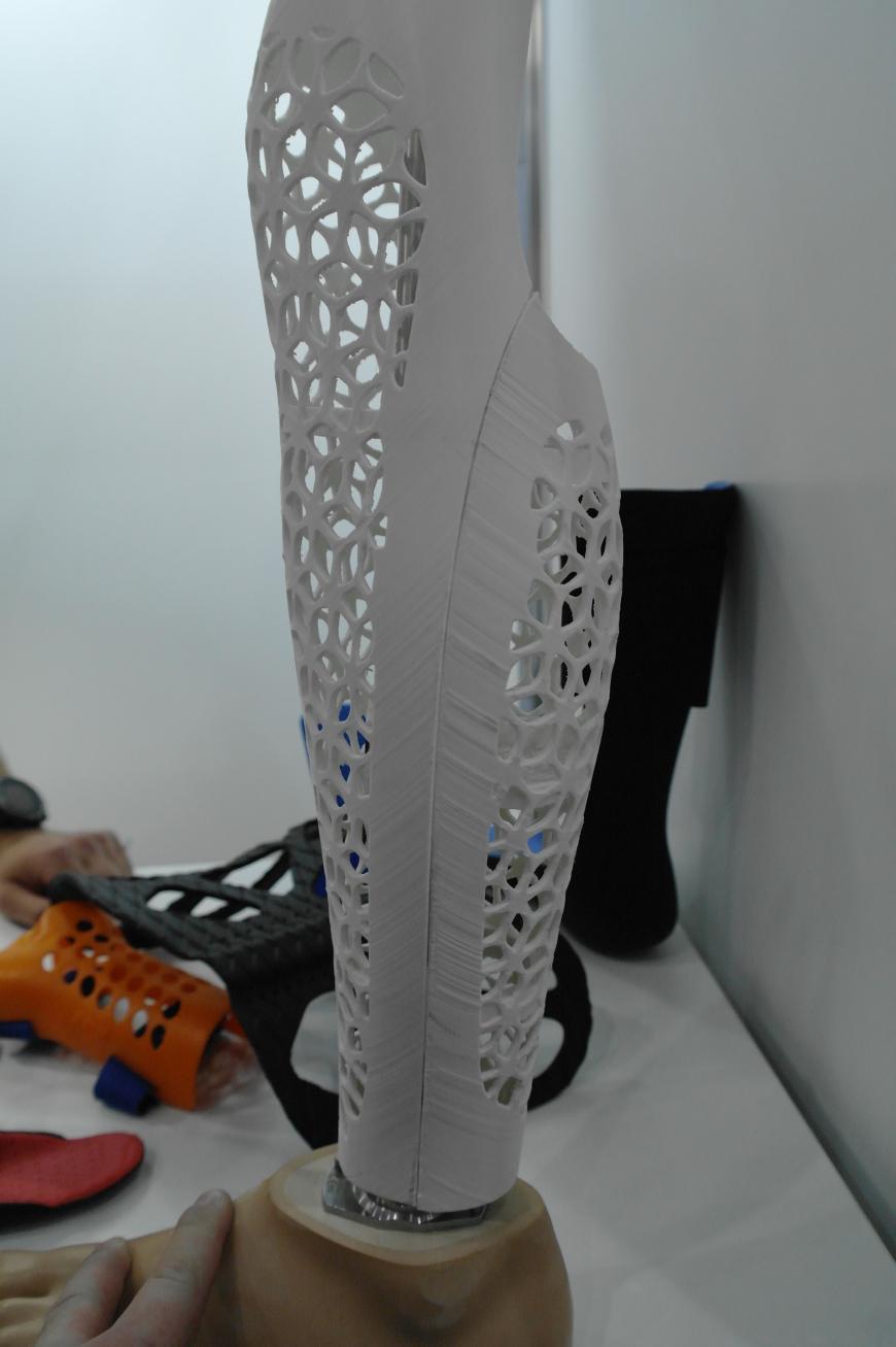 Аддитивные технологии в протезировании