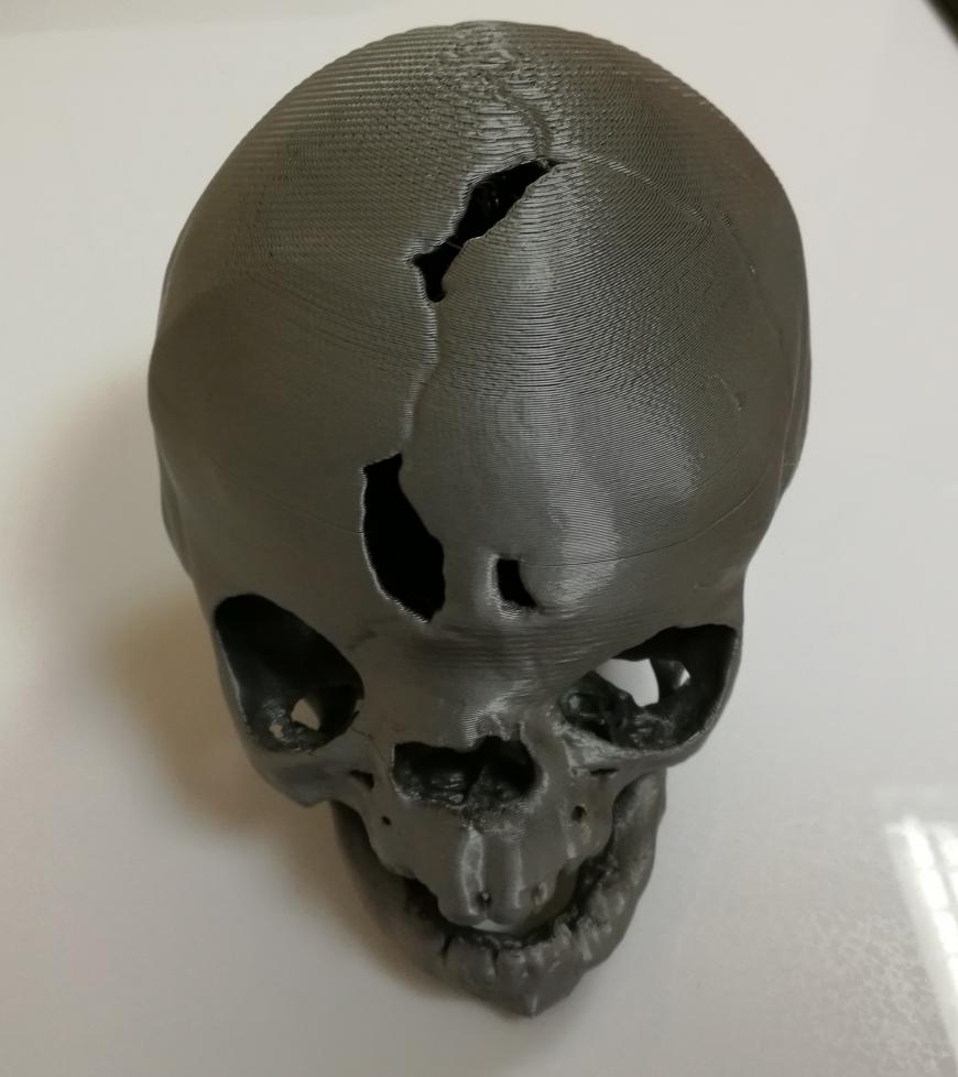 Применение 3D-печати в детской нейрохирургии.