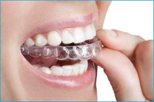 Применение 3D-печати в стоматологии
