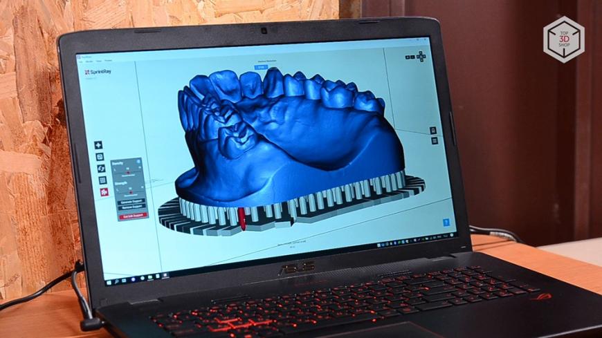 Убийца Form 2? Обзор 3D-принтера MoonRay S100 для стоматологов
