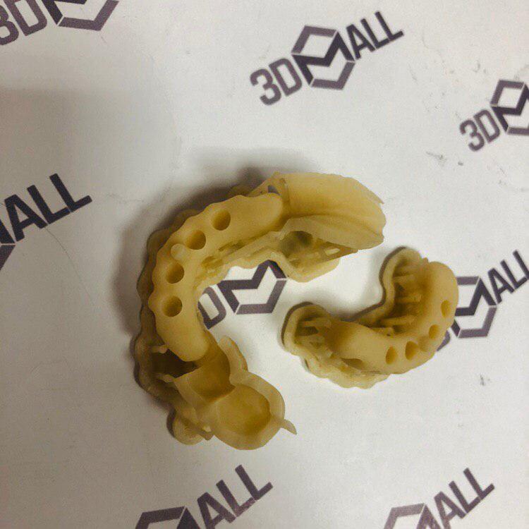 Временные коронки из фотополимера по технологии SLA