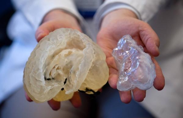 Напечатанные с помощью 3D-технологии части тела помогут врачам лучше подготовиться к реальной операции
