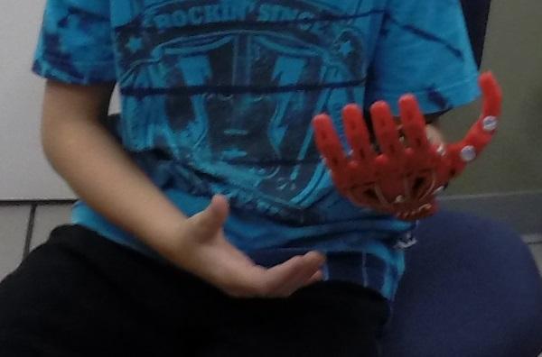 Для шестилетнего мальчика собрали 3D-печатный протез руки