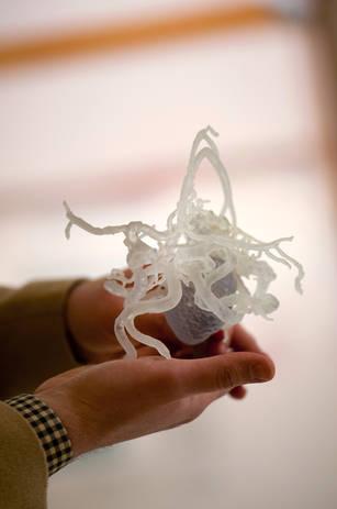 Напечатанные с помощью 3D-технологии части тела помогут врачам лучше подготовиться к реальной операции