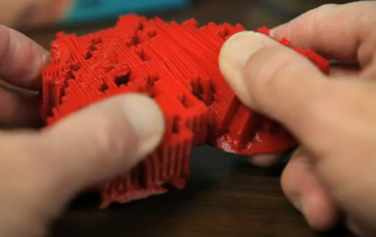 3D-принтер помог четырнадцатимесячному ребенку справиться с пороком сердца