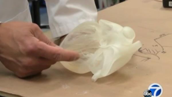 Стэнфордские ученые создают модели органов с помощью 3D-печати