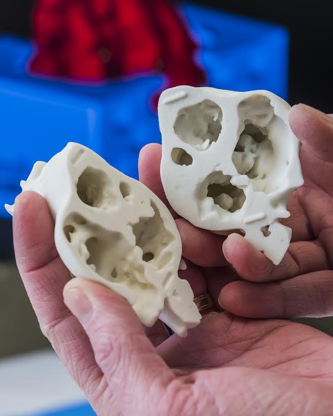3D-принтеры на службе кардиохирургии