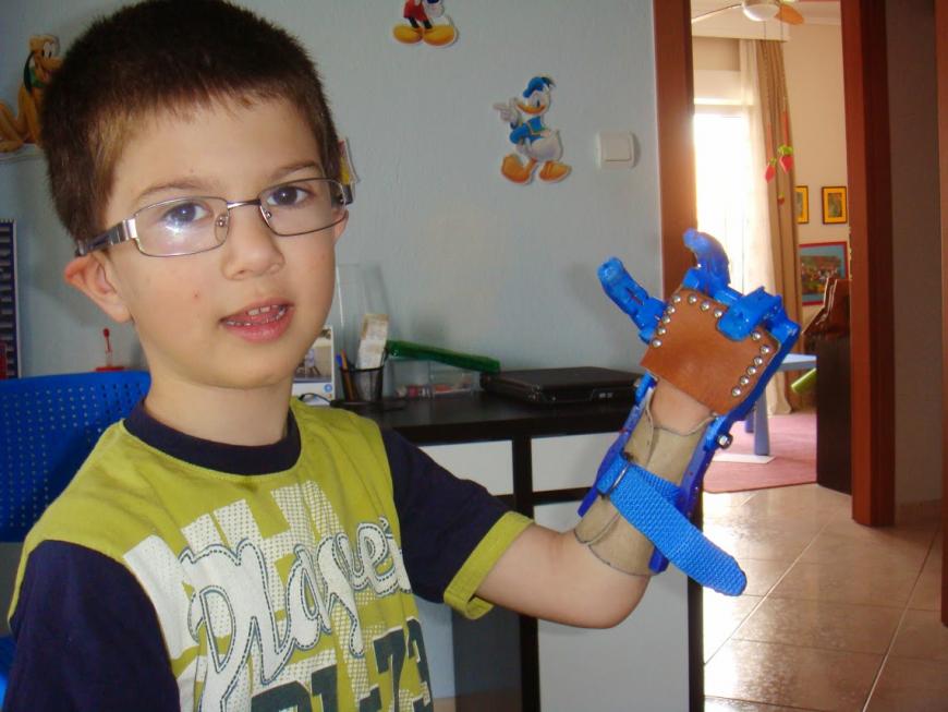 Участники сообщества e-NABLE собрали протез руки с 3 пальцами для маленького мальчика из Греции