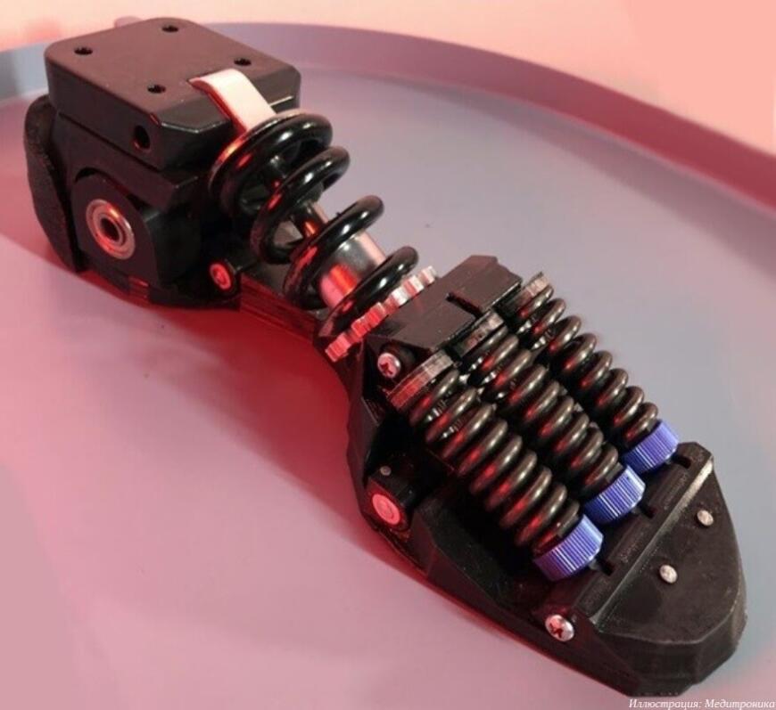 Компания «Медитроника» перешла на отечественные титановые комплектующие 3D-печатных протезов