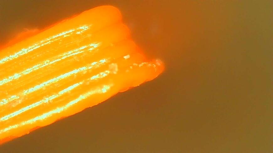 Проблема со слоновьей ногой