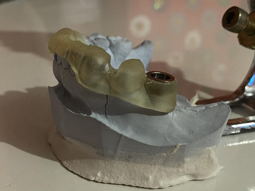 Хирургический шаблон из фотополимера Harz labs Dental yellow на Form2.