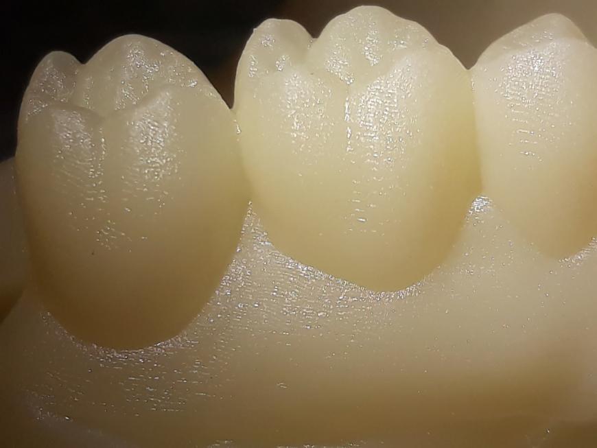 Зубы 50 и 25 микрон, из eSUN Standart Resin White UNIZ Slash PLUS