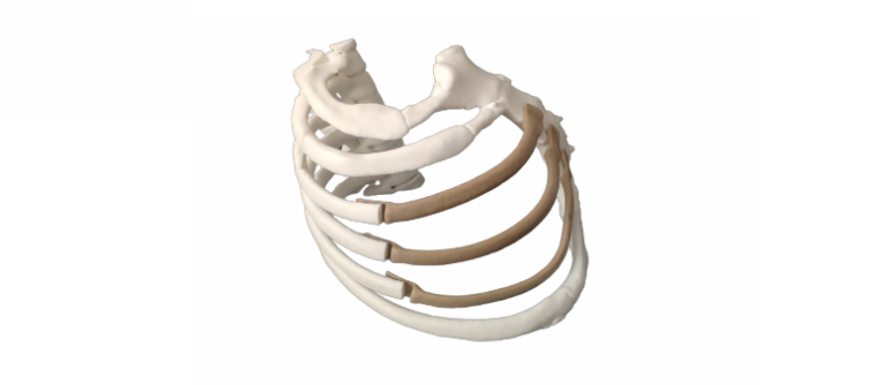 3D-принтеры от Intamsys открывают новые возможности по установке имплантатов из PEEK