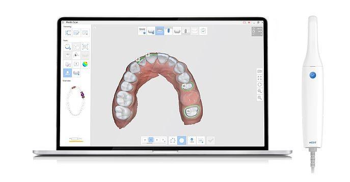 Обзор интраорального 3D-сканера Medit i500