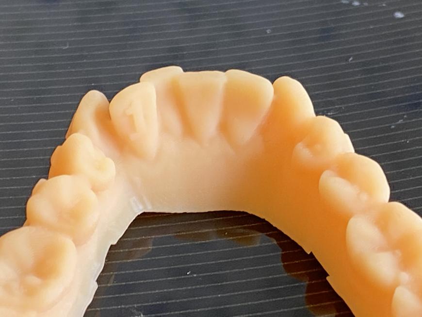 Мастер-модели из Hardlight dental skin