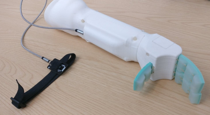 Британские инженеры сконструировали 3D-печатный бионический протез для малышей