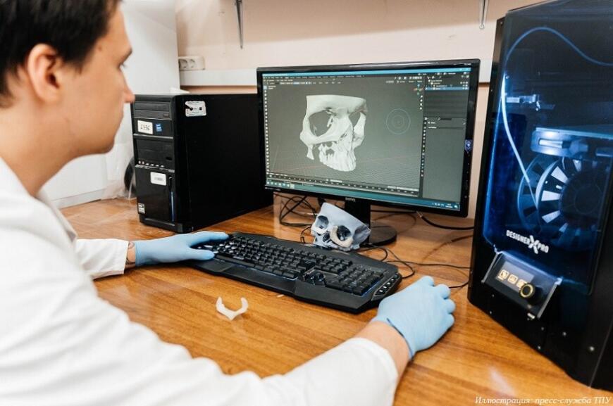 Томские хирурги применяют 3D-печатные полимерные имплантаты