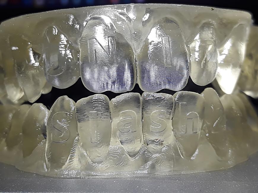 Протестируем зубами UNIZ Slash 2 + Harz Labs + ESUN