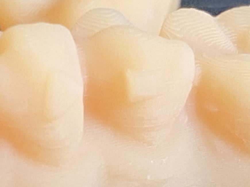 Мастер-модели из Hardlight dental skin