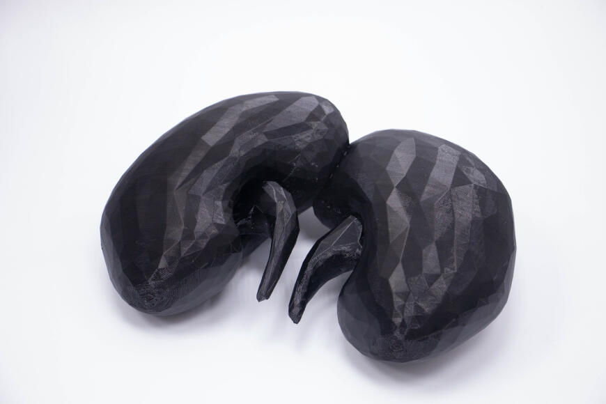 Кейс для клиники - почки в стразах