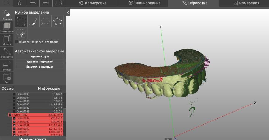 RangeVision QUANT – высокоточный и быстрый 3D-сканер для стоматологов и оцифровки мелких объектов. Обзор от 3Dtool