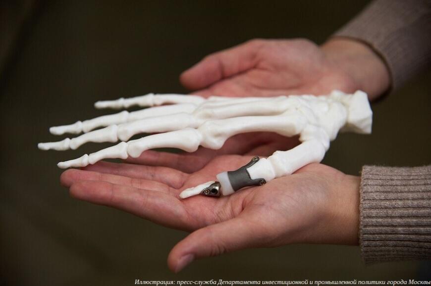 Столичные предприятия развивают применение аддитивных технологий в медицине и протезировании Столичные предприятия развивают применение аддитивных технологий в медицине и протезировании