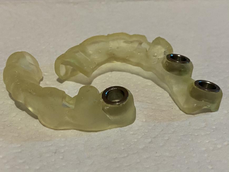 Хирургический шаблон из фотополимера Harz labs Dental yellow на Form2.