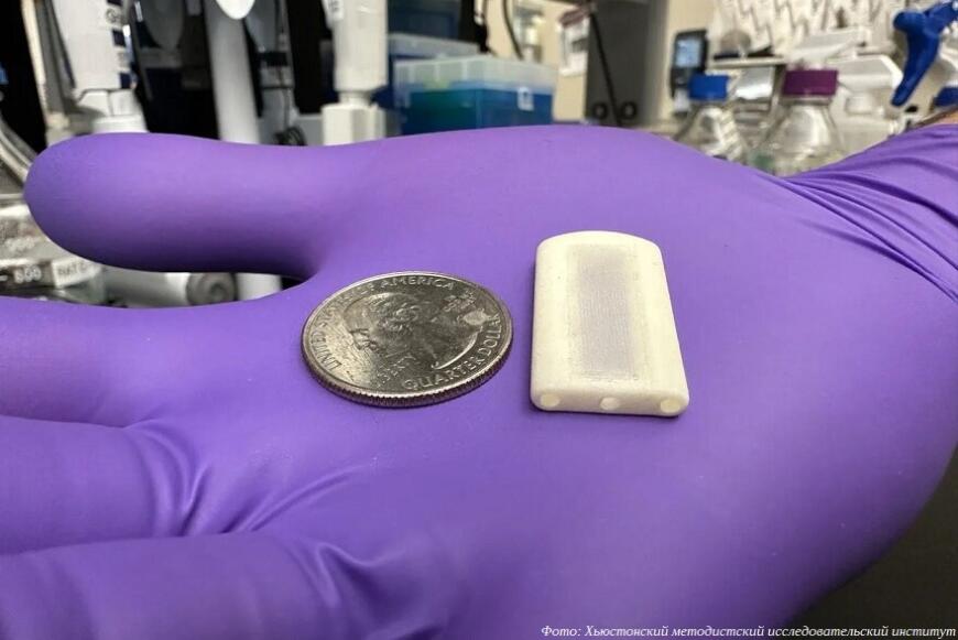 Американские ученые создали 3D-печатные имплантаты для лечения сахарного диабета