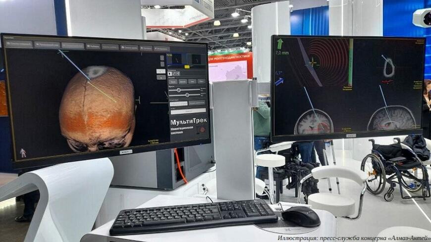Концерн «Алмаз-Антей» представил оптическую навигационную систему для проведения нейрохирургических операций Концерн «Алмаз-Антей» представил оптическую навигационную систему для проведения нейрохирургических операций