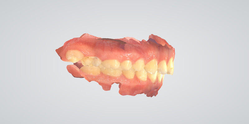 Обзор 3D сканера Pingtum Panda P2 помощник стоматолога