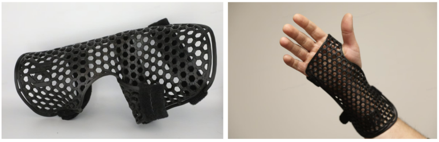 3D-печать на месте в современной медицине: как XO Armor приближает персонализированные ортезы к пациентам