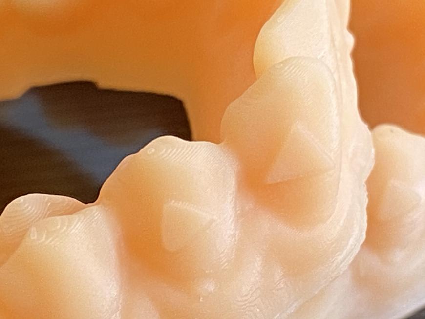 Мастер-модели из Hardlight dental skin