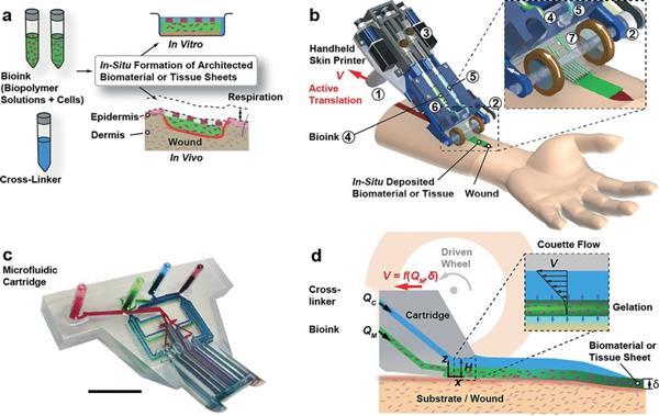 Новые технологии в медицине – заживление ран на коже с помощью 3D-биопринтера